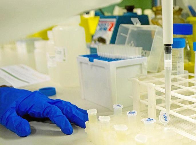 El IdISBa ultima una prueba para detectar el coronavirus