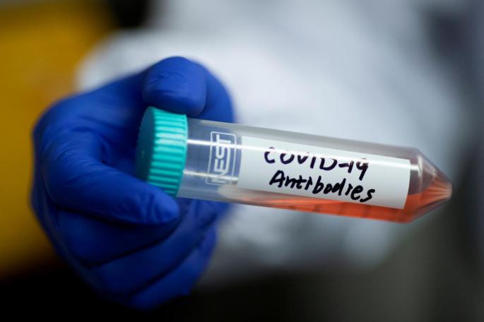 muestra de coronavirus