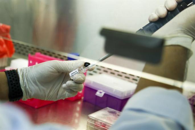 Las cifras del coronavirus en Baleares a 4 de junio