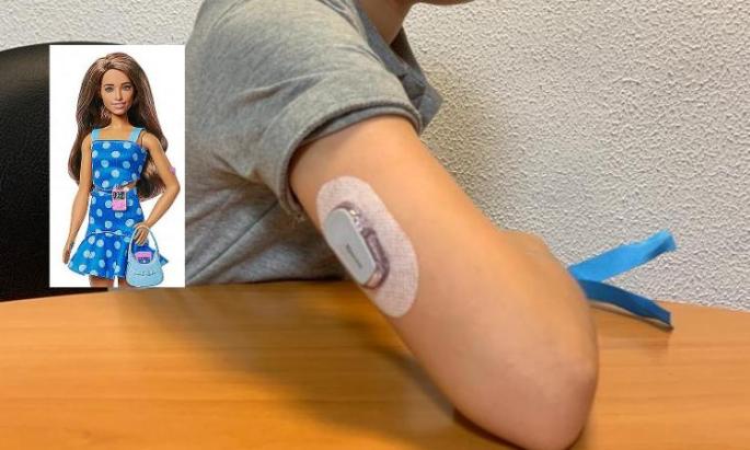 Barbie normaliza la diabetes Tipo 1