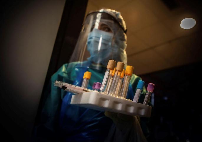Test PCR en hospital de Aranda