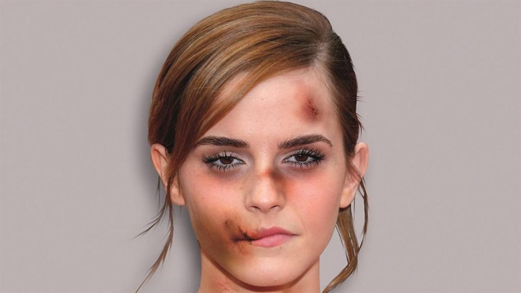 Emma Watson