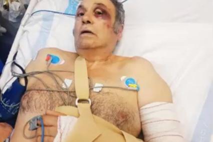 taxista agredido TVE