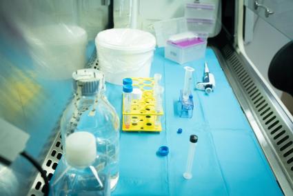 Córdoba.- Salud confirma la presencia de Clostridium prefingens en la muestra de montadito de pringá