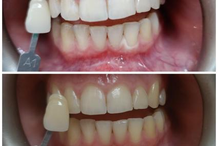 Dentistas