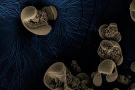 Un accidente en un laboratorio descubre una rara bacteria que come metales