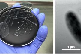 Descubierta una nueva especie de legionela en Mallorca