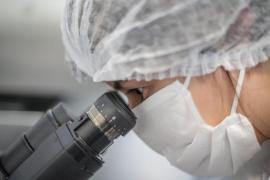 Baleares registra 21 casos de hepatitis A hasta noviembre de 2025, la mitad que el año pasado