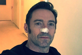 El actor Hugh Jackman ha sido operado por sexta vez de cáncer de piel