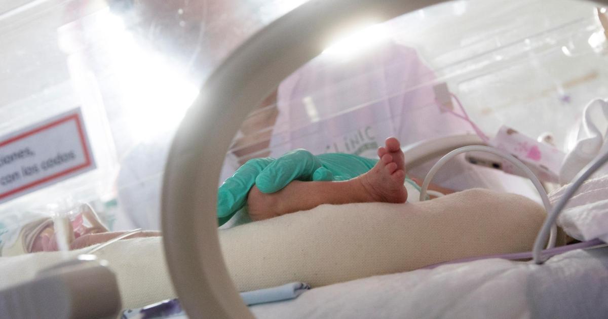 Baleares valora ampliar la prueba del talón para detectar fibrosis quística en población de origen extraeuropeo
