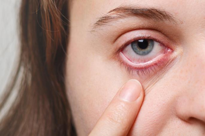 Ojos
